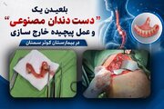 انجام موفق عملیات جراحی پیچیده  بازکردن مری و خارج کردن دندان مصنوعی در بیمارستان کوثر سمنان