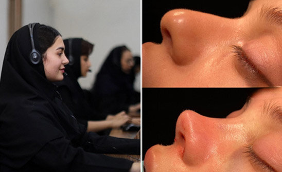 پزشک 24 مشاوره و نوبت جراحی بینی کارمندان دولت