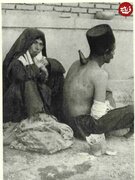 مرد قاجاری در حال حجامت شدن توسط یک زن / عکس