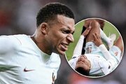 امباپه شاید ماه‌ها دور از میادین باشد!