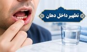 احکام شرعی | خون لثه در دهان؛ برای تطهیر چند بار باید آبکشی کرد؟