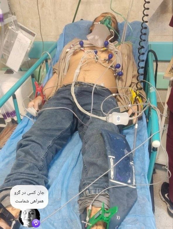 هشدار| انتشار تصویری ناراحت‌کننده از منتقد پیشکسوت تئاتر/ رضا آشفته سرگردان بین بیمه و بیمارستان
