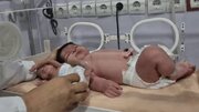 ۲ نوزاد با اختلاف وزن ۱۱ برابری در بندرعباس متولد شدند + فیلم