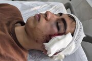 ضرب‌وشتم دانش‌آموز با دسته صندلی / روایت پدر از خشونت علیه فرزندش در دبیرستان دهبکری بم / آموزش‌وپرورش وعده پیگیری داد + عکس دلخراش