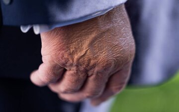 قابهایی از پوشانده شدن دست ترامپ با آرایش برای سانسور تورم + تصاویر