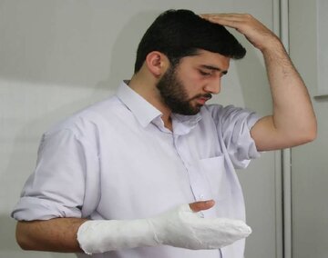 حکم وضوی جبیره در صورت پوشیده بودن بیشتر اعضای وضو چیست؟